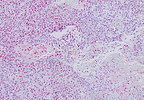 Molecular Instruments &amp; Empire Genomics Launch NISH Powered by HCR™ Pro: The Largest Ready-to-Use, Fully Automated ISH Library, Exclusively Available Worldwide on NeoPATH Pro