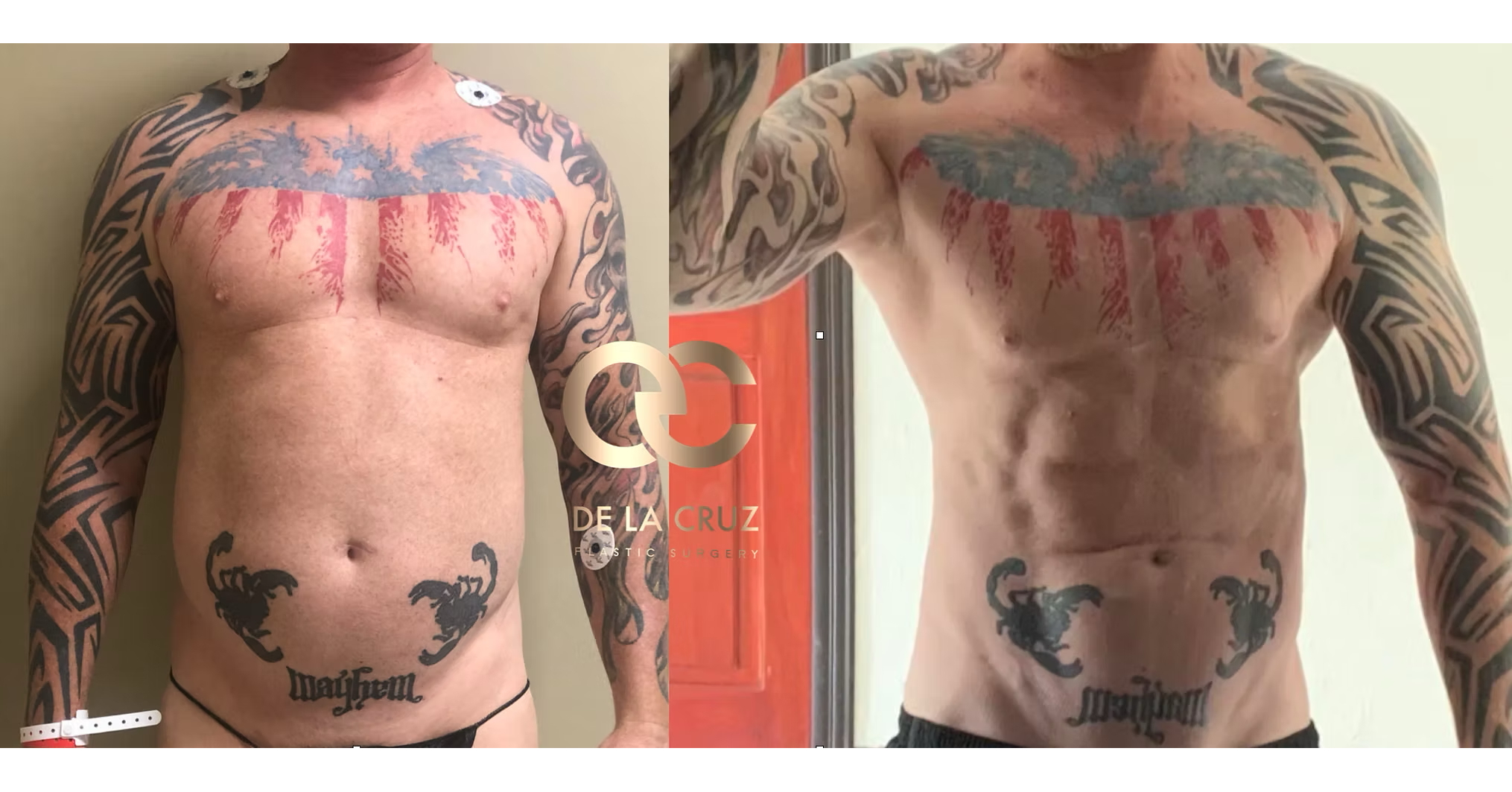 Where Surgery Meets Sculpture: Dr. Emmanuel De La Cruz Brings a Fine Artist's Eye to Modern Body Contouring