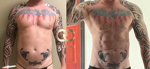 Where Surgery Meets Sculpture: Dr. Emmanuel De La Cruz Brings a Fine Artist's Eye to Modern Body Contouring