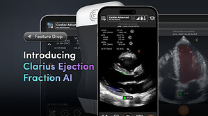 FDA Clears Clarius Ejection Fraction AI to Deliver Objective, Real-Time Cardiac Ultrasound Assessments for Primary Care and Emergency Medicine