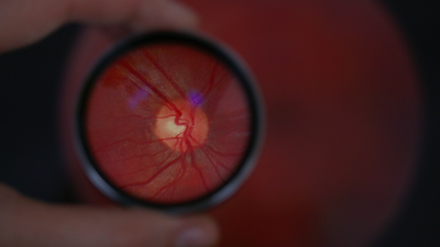 L'ÉTS et DIAGNOS lancent une Chaire de recherche en intelligence artificielle appliquée à l'imagerie médicale