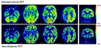 UZ and KU Leuven: NeuroEXPLORER PET makes detection of early phases of diseases possible