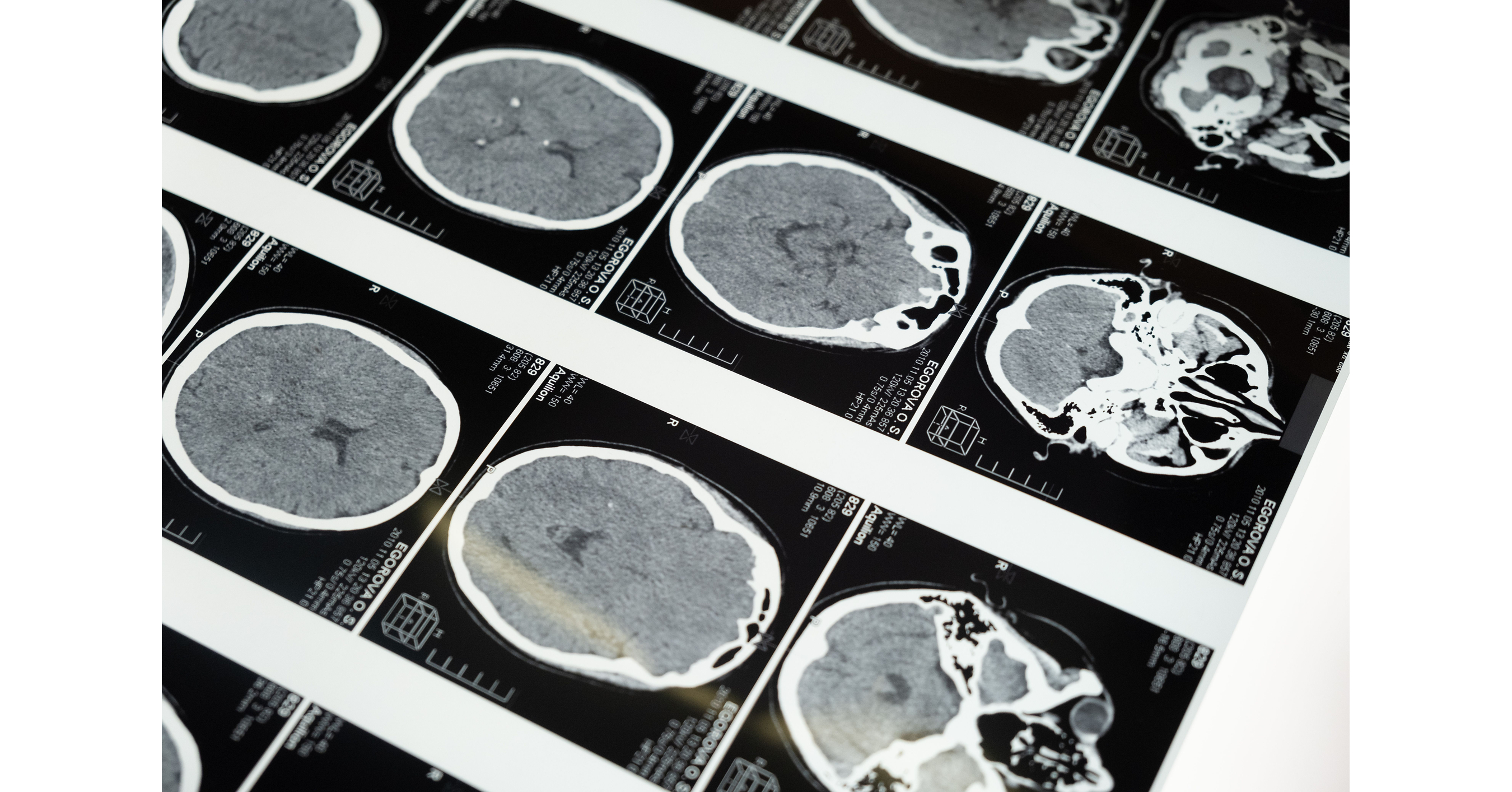 Cerebral Palsy Guide Releases Updated Guidance on Transitioning to Adult Healthcare