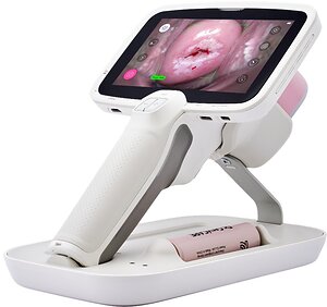 NTL HEALTHCARE entra no mercado sul-americano de rastreamento de câncer cervical com Dr.CerviCARE® AI