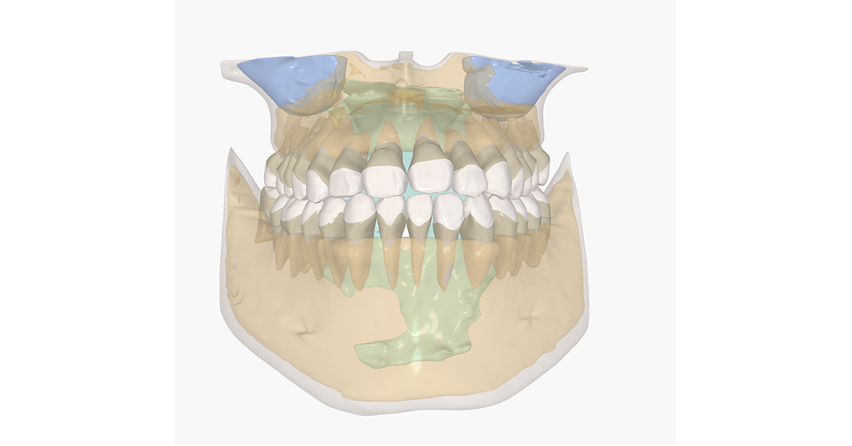 Angel Aligner™ Launches iOrtho™ Release 6.2, Bringing Deeper Diagnostics, Smarter Prescriptions, and Faster Planning to Orthodontists Nationwide