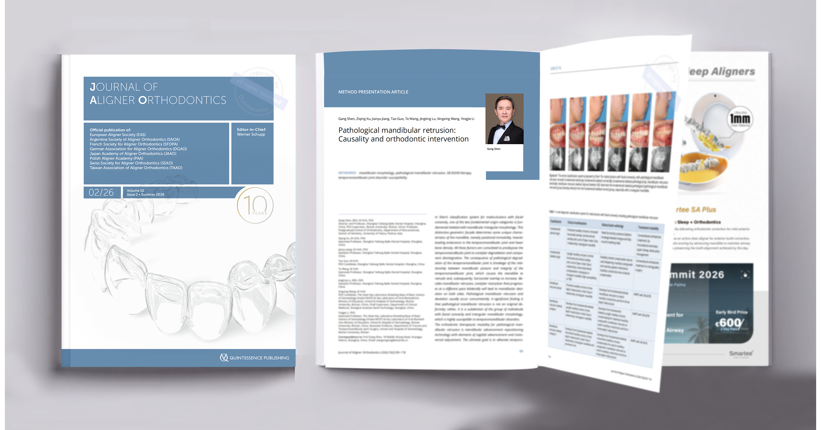 Professor Gang Shen's Orthodontic Team Publishes Third Consecutive Paper in the Journal of Aligner Orthodontics