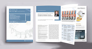 Professor Gang Shen's Orthodontic Team Publishes Third Consecutive Paper in the Journal of Aligner Orthodontics