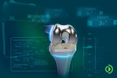 Advita Ortho's Newton® knee balancing intelligence transforms real-time soft tissue measurements into objective intraoperative data, supporting more consistent planning and laying the foundation for predictive decision-making in total knee arthroplasty.