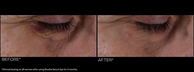 Visible results after application. 