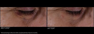 Visible results after application. 