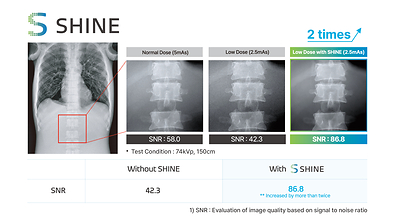SHINE More Than Doubles Signal-to-Noise in Static X-ray Imaging