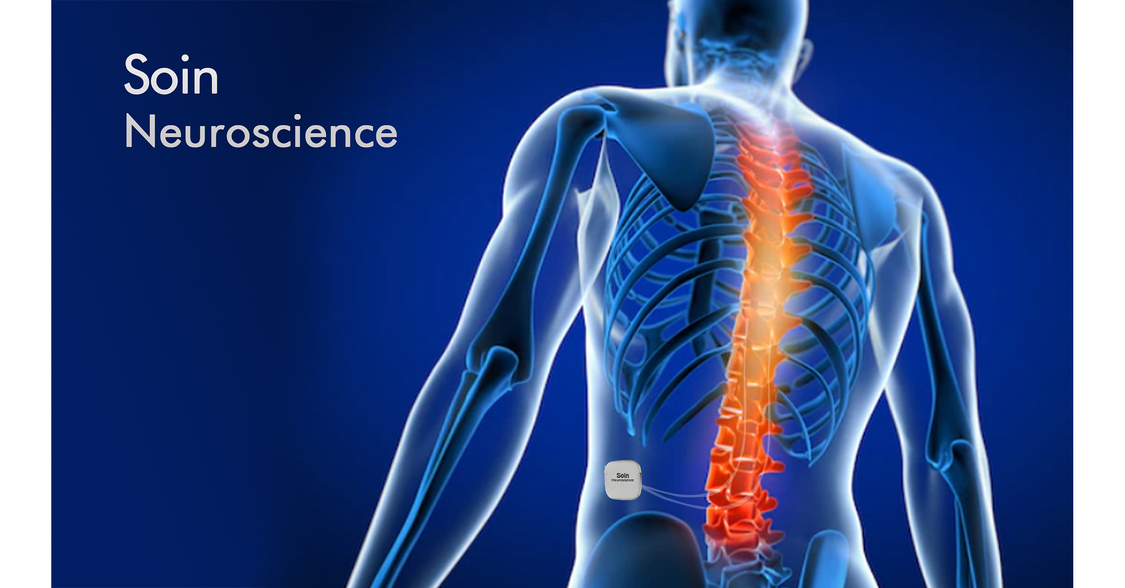 BIOTRONIK Neuro Acquires Spinal Cord Stimulation System from Soin Neuroscience