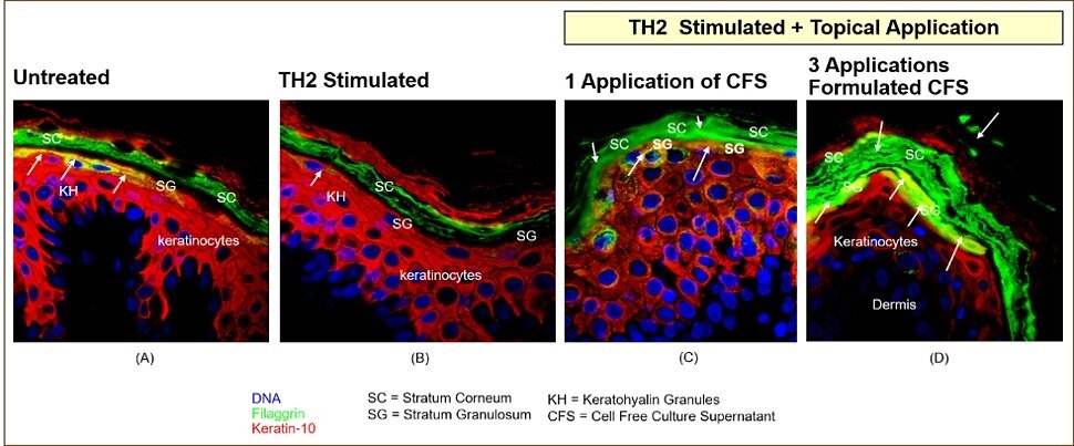 TechBeetle | Azitra, Inc. Announces Breakthough Repeat Dose and Anti-Wrinkle Ex Vivo Results for ATR-COSF Program, De...