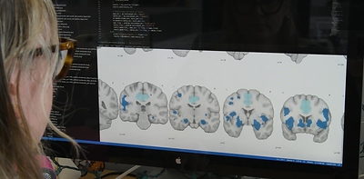 Researchers at Florida International University have linked certain sleep disorders to structural changes in the brain. (Credit: Taimy Alvarez/Florida International University)