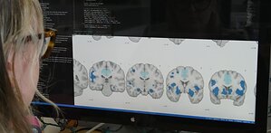 Sleep disorders don't just exhaust you. A new Florida International University study shows they change your brain
