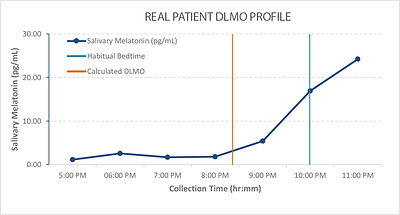 Example Dim Light Melatonin Onset (DLMO) Profile Example Dim Light Melatonin Onset (DLMO) Profile