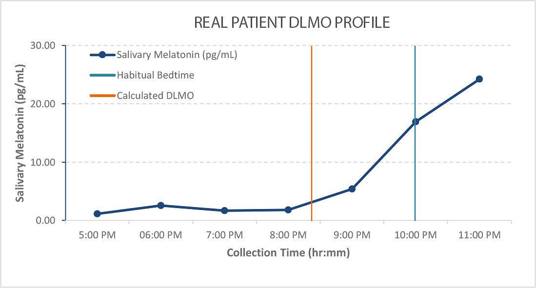 New Study in Sleep Medicine Introduces a Clinical Framework for Interpreting Home-Based DLMO Assessments