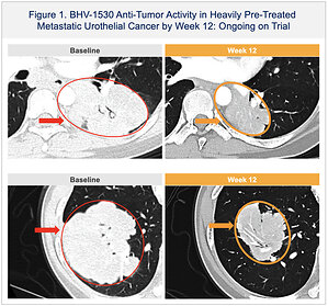 Biohaven to Present New Clinical Data at ESMO Congress on BHV-1530, a Novel FGFR3-Directed ADC With a Proprietary Topoisomerase I (TopoIx) Payload