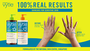 Homegrown and Science-Backed: Vytle Re-Imagines Sensitive Skincare for Singapore's Hot and Humid Climate