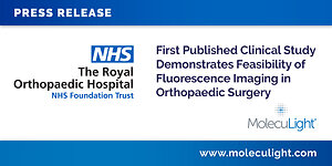 First Published Clinical Study Demonstrates Feasibility of Fluorescence Imaging in Orthopaedic Surgery