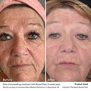 Collagen P.I.N.® Announces Winners of the 2026 Transformation Awards Celebrating Outstanding Microneedling Results