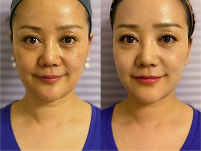 Customer before and after image.