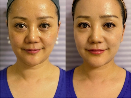 Customer before and after image. Customer before and after image.