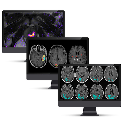 Cortechs.ai Expands European CE Marking Across AI Imaging Platform, Accelerating Global Growth