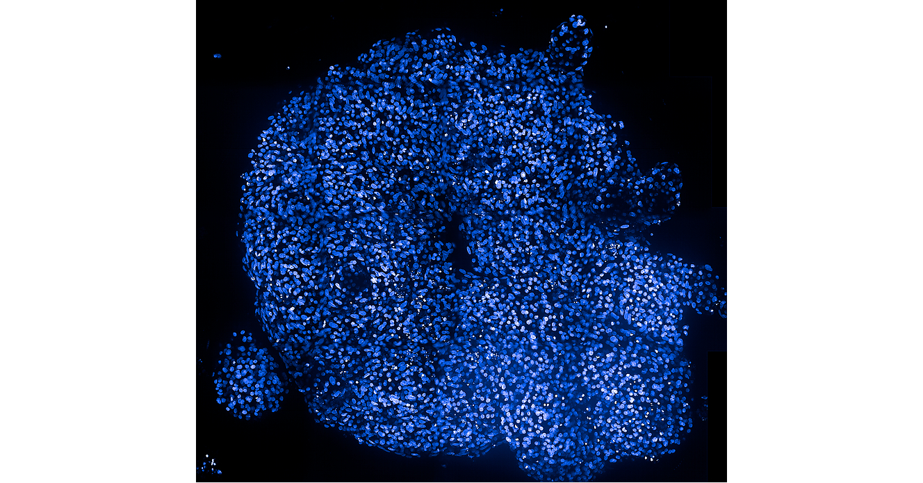 Molecular Devices and HeartBeat.bio Help Researchers Identify Cardiac Safety Risks Earlier with New Human Cardiac Organoid Solution