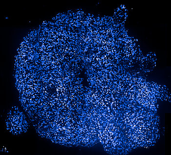 Tri-lineage cardioid organoid generated using the 3D Ready™ Cardioid Supplement Kit. Image courtesy of Axxam S.p.A.