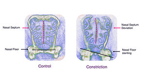 Groundbreaking Research by CTOR Explores the Connection Between Bite, Facial Growth and Breathing