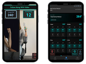 Exer AI Announces Exer Scan App's Hand/Wrist Module Introduced at Mayo Clinic to Advance Musculoskeletal Care and Clinical Workflow Efficiency