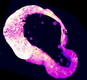Cells use a little-known molecule to protect themselves from iron overload