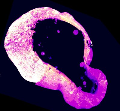 Cells use a little-known molecule to protect themselves from iron overload