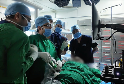 Dr. Abhishek Singh (Urology, lead investigator) successfully takes a renal mass biopsy sample using the Focalist system with a core biopsy device.