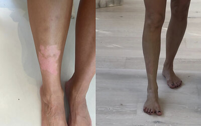 Kim Kardashian Before + After Image (Courtesy of Kim Kardashian)