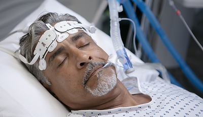 Masimo smartSedLine™ brain function monitoring technology with the SedLine® EEG Sensor. smartSedLine features an AI-powered Patient State Index (PSi) algorithm designed to provide clinicians with more responsive and stable insight into brain activity during anesthesia. (Photo: Masimo)