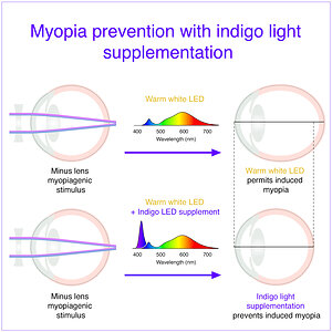 Restoring a Missing Slice of Sunshine to Indoor Light May Help Prevent Myopia
