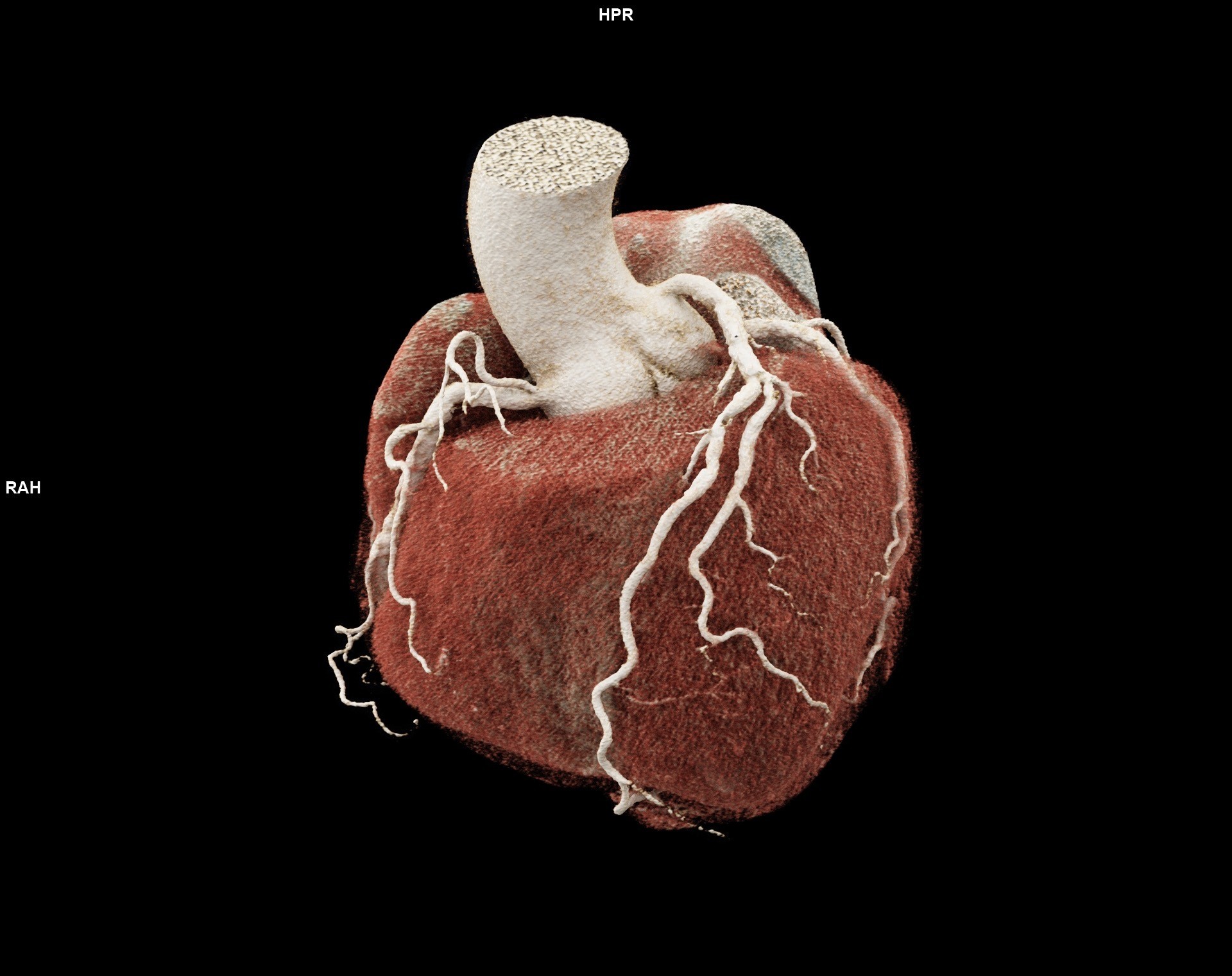 Memorial Brings the Future of Heart Imaging to South Florida