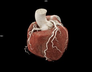 Memorial Brings the Future of Heart Imaging to South Florida