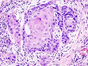 Mapping Smarter Drug Delivery for Treating Oral Cancers: A Hasanuddin University Review