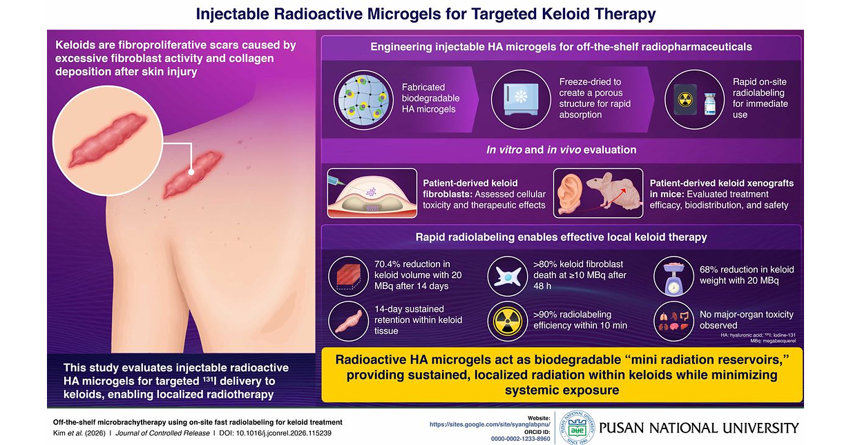 Pusan National University Develops Injectable Microgels for Targeted Keloid Radiotherapy