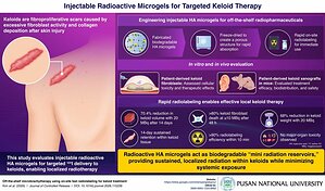 Pusan National University Develops Injectable Microgels for Targeted Keloid Radiotherapy