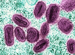 Mathematical Model Shows 97.8% Reduction in Simulated Mpox Infections Under a Four-Intervention Strategy