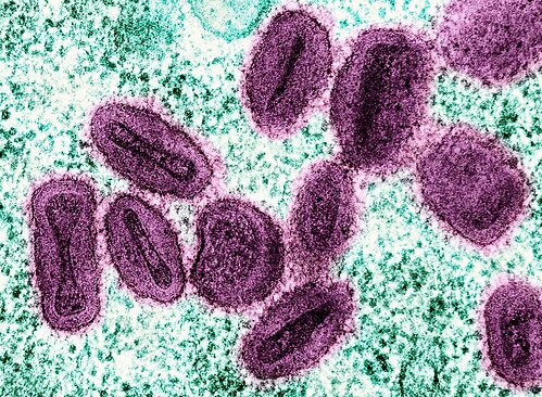 Led by Prof. Kasbawati from Hasanuddin University, Indonesia, this study uses mathematical modeling analysis to evaluate effective Mpox control strategies. The findings suggest that a full-control strategy, combining vaccination, treatment, quarantine, and educational campaigns, is the most effective and cost-efficient approach to limit transmission in a simulated outbreak.