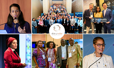 THE SKIN OF COLOR SOCIETY (SOCS) UNITES 21 GLOBAL ORGANIZATIONS TO ADVANCE SKIN OF COLOR DERMATOLOGY