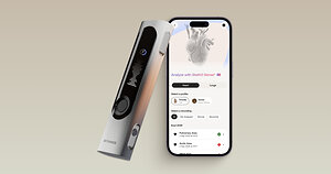 Withings Introduces StethO Sense, Bringing Heart and Lung Sound Analysis to BeamO
