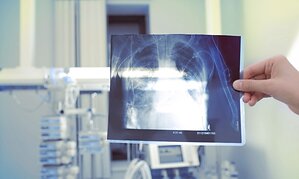 Brayton Purcell LLP Highlights Business Insurance Coverage of Growing Artificial Stone Silicosis Crisis