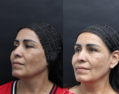 Before & After Image