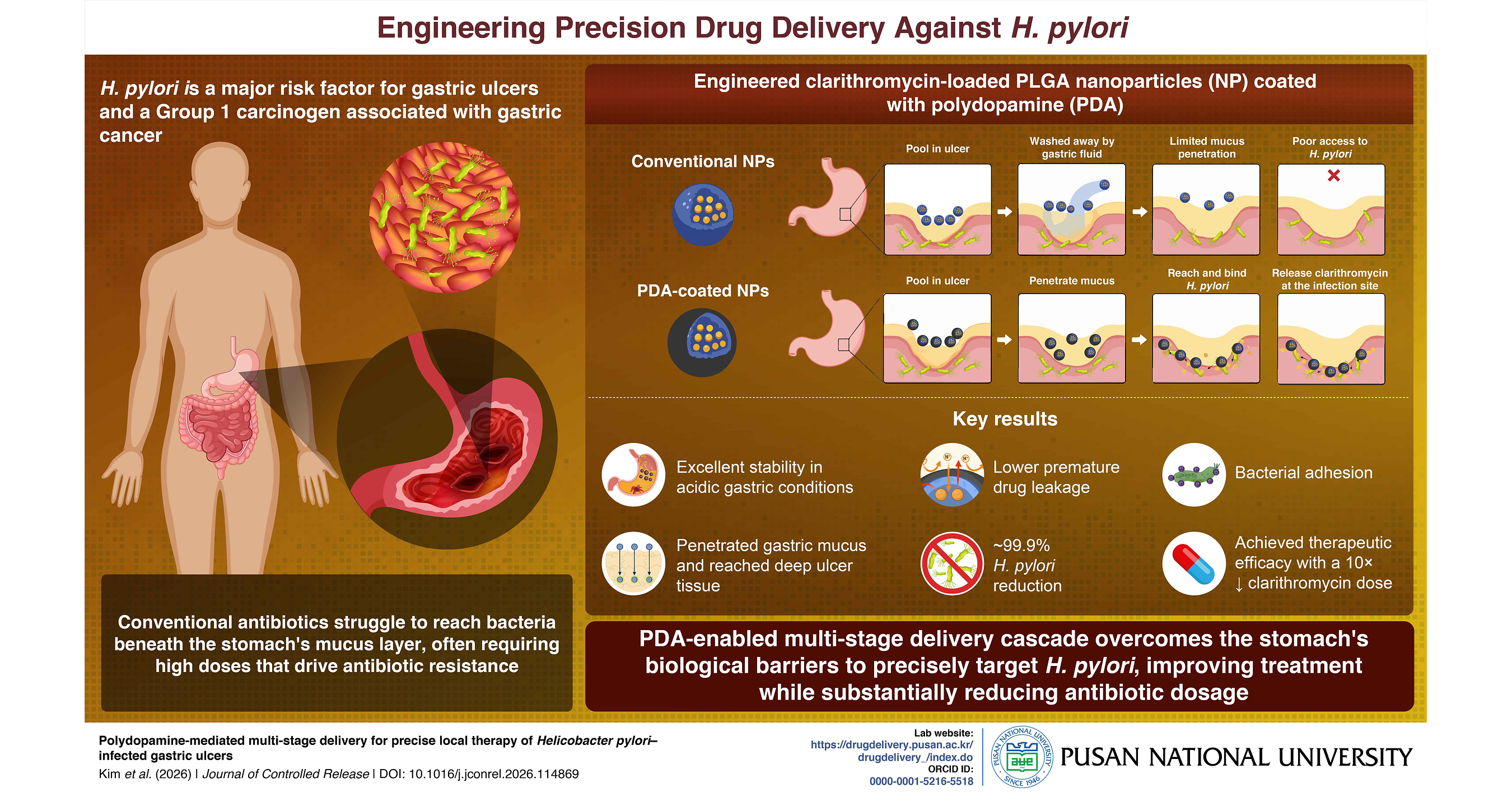 Pusan National University Develops Smart Nanoparticles That Deliver Antibiotics Directly to H. pylori